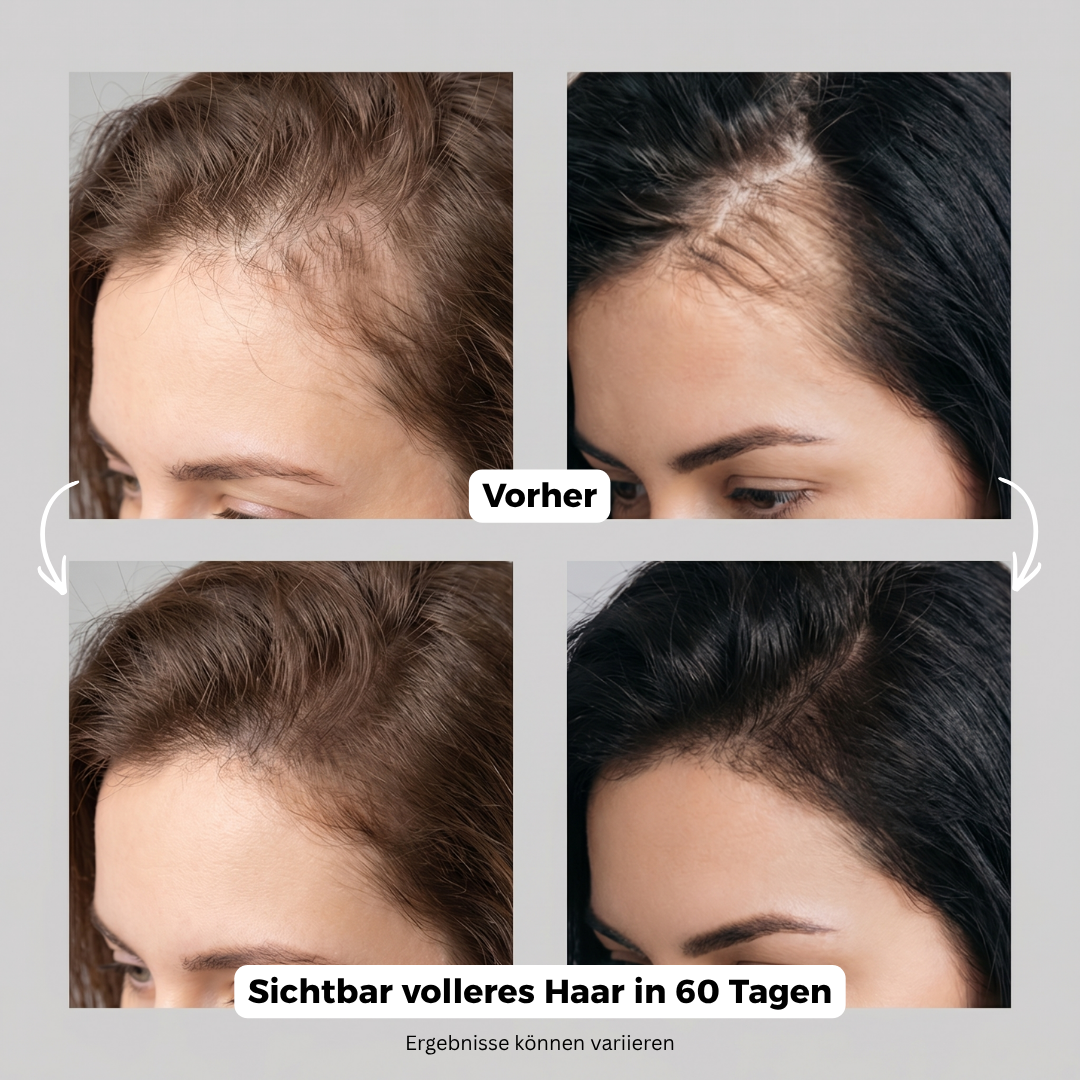 Scalp Lumina