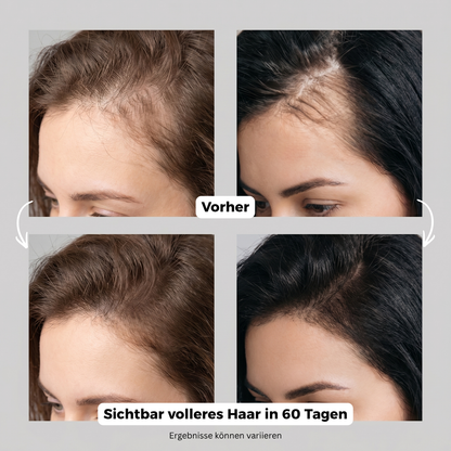Scalp Lumina
